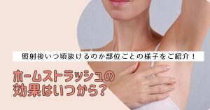 ホームストラッシュの効果はいつから？照射後いつ頃抜けるのか部位ごとの様子をご紹介！